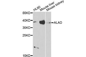 Western blot analysis of extracts of various cell lines, using ALAD antibody. (ALAD antibody)