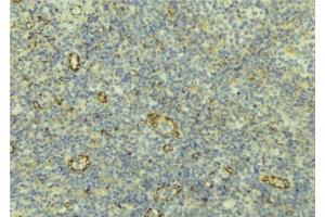 ABIN6277008 at 1/100 staining Human lymph tissue by IHC-P. (AOC3 antibody  (Internal Region))