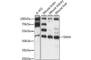 Western blot analysis of extracts of various cell lines, using SNX4 antibody (ABIN7270504) at 1:1000 dilution. (Sorting Nexin 4 antibody  (AA 1-250))