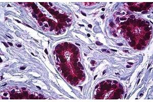Human Breast: Formalin-Fixed, Paraffin-Embedded (FFPE) (IGF2R antibody  (AA 2441-2490))