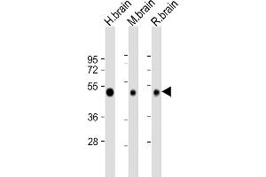 Western Blotting (WB) image for anti-Neuronal Pentraxin 1 (NPX1) (AA 322-350) antibody (ABIN652309)