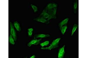 Immunofluorescent analysis of Hela cells using ABIN7160378 at dilution of 1:100 and Alexa Fluor 488-congugated AffiniPure Goat Anti-Rabbit IgG(H+L) (MYBL2 antibody  (AA 188-366))