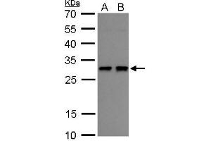 Western Blotting (WB) image for anti-Heme Oxygenase (Decycling) 1 (HMOX1) antibody (ABIN2854952)