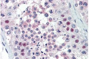 Human Testis (formalin-fixed, paraffin-embedded) stained with PRMT5 antibody ABIN337159 at 1:100 followed by biotinylated goat anti-rabbit IgG secondary antibody ABIN481713, alkaline phosphatase-streptavidin and chromogen. (PRMT5 antibody)
