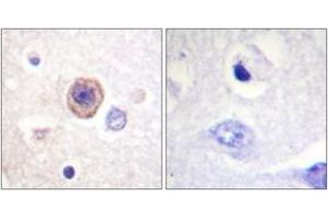 Immunohistochemistry analysis of paraffin-embedded human brain tissue, using Tryptophan Hydroxylase (Ab-58) Antibody. (Tryptophan Hydroxylase 1 antibody  (AA 26-75))