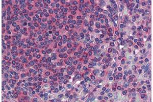 Anti-TM9SF3 antibody  ABIN960828 IHC staining of human spleen. (TM9SF3 antibody  (Internal Region))