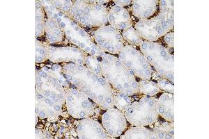 Immunohistochemistry of paraffin-embedded mouse kidney using MMP9 antibody (ABIN4904401) at dilution of 1:100 (40x lens). (MMP 9 antibody)
