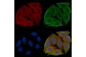 Phospho-SLP76 (Tyr128) Antibody staining Hela cells(45 min of heat-shock treatment) by IF/ICC.