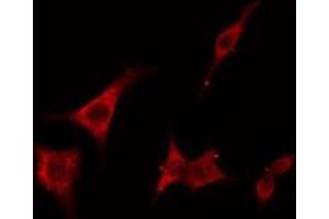 ABIN6275404 staining RAW264. (FNTB antibody  (Internal Region))