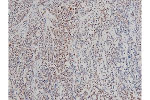 ABIN6267554 at 1/100 staining rat tumor tissue sections by IHC-P.