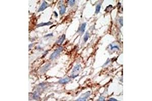 Image no. 2 for anti-ISG15 Ubiquitin-Like Modifier (ISG15) (AA 39-68), (N-Term) antibody (ABIN356679) (ISG15 antibody  (N-Term))