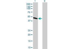 Western Blot analysis of PAFAH1B1 expression in transfected 293T cell line by PAFAH1B1 monoclonal antibody (M03), clone 5A5.