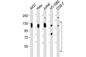 Western blot testing of LAMP antibody at 1:2000 dilution. (LAMP1 antibody)