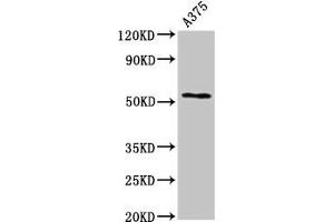 Western Blot Positive WB detected in: A375 whole cell lysate All lanes: CPE antibody at 2. (CPE antibody  (AA 252-363))