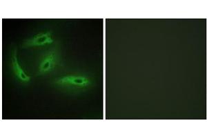 Immunofluorescence analysis of HeLa cells, using CDKL4 antibody. (CDKL4 antibody  (C-Term))