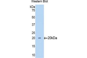 Western blot analysis of the recombinant protein. (CYP3A7 antibody  (AA 344-497))