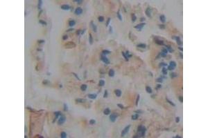 IHC-P analysis of Human Tissue, with DAB staining. (SFRP1 antibody  (AA 32-314))