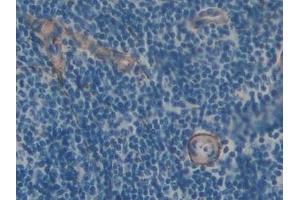 Immunohistochemistry (IHC) image for anti-Fibrillin 1 (FBN1) (AA 751-895) antibody (ABIN7432139)