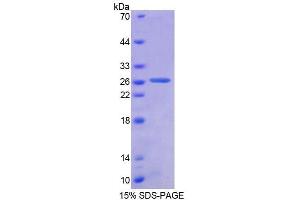 SDS-PAGE (SDS) image for Ancient Ubiquitous Protein 1 (Aup1) (AA 201-410) protein (His tag) (ABIN6238740) (Ancient Ubiquitous Protein 1 Protein (Aup1) (AA 201-410) (His tag))