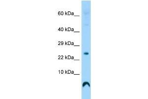 Host: Rabbit Target Name: C17orf108 Sample Type: Fetal Heart lysates Antibody Dilution: 1. (LYRM9 antibody  (Middle Region))