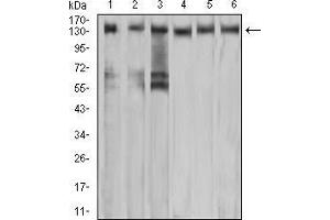 Western blot analysis using MET mouse mAb against A549 (1), COS7 (2), Hela (3), HEK293 (4), HepG2 (5), and A431 (6) cell lysate. (c-MET antibody  (AA 743-932))