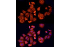 Immunofluorescence analysis of A-549 cells using  Rabbit pAb (ABIN1678685, ABIN3015308, ABIN3015309 and ABIN6213977) at dilution of 1:150 (40x lens). (APAF1 antibody  (AA 1-250))
