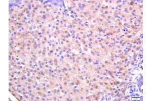 Formalin-fixed and paraffin embedded rat pancreas tissue labeled with Rabbit Anti-CTDSP2 Polyclonal Antibody, Unconjugated (ABIN2559702) at 1:200 followed by conjugation to the secondary antibody and DAB staining