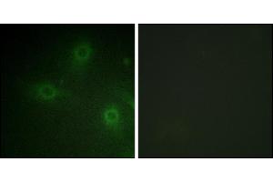 Immunofluorescence analysis of HeLa cells, using Neutrophil Cytosol Factor 1 (Ab-304) antibody. (NCF1 antibody)