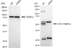 Western blotting analysis using sonic hedgehog antibody (ABIN7800969).