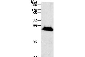 Western Blot analysis of Human liver cancer tissue using RBMS3 Polyclonal Antibody at dilution of 1:1000 (RBMS3 antibody)