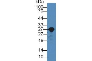 Western Blot; Sample: Rat Liver lysate; Primary Ab: 2µg/mL Rabbit Anti-Rat GSTa3 Antibody Second Ab: 0. (GSTA3 antibody  (AA 1-221))