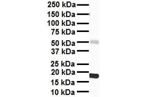 WB Suggested Anti-PPARA antibody Titration: 1 ug/mL Sample Type: Human heart (PPARA antibody  (Middle Region))