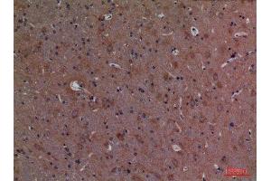 Immunohistochemistry (IHC) analysis of paraffin-embedded Rat Brain, antibody was diluted at 1:100. (CALB1 antibody  (C-Term))