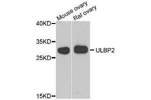 Western blot analysis of extract of mouse ovary and rat ovary cells, using ULBP2 antibody. (ULBP2 antibody)