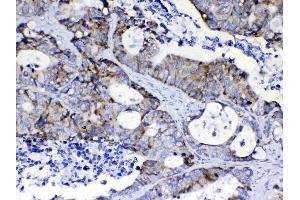Immunohistochemistry (IHC) image for anti-Phosphoinositide-3-Kinase, Catalytic, beta Polypeptide (PIK3CB) (AA 556-598), (Middle Region) antibody (ABIN5518862)