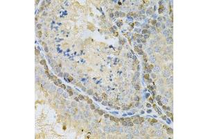 Immunohistochemistry of paraffin-embedded mouse testis using BUB1 Antibody. (BUB1 antibody  (AA 1-300))