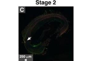 Immunohistological staining of artery tissues from diabetic subjects showing colocalization of serum proteins and mineral deposits. (Fetuin A antibody  (AA 200-240) (AbBy Fluor® 594))
