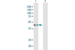 Western Blot analysis of ALG2 expression in transfected 293T cell line by ALG2 MaxPab polyclonal antibody. (ALG2 antibody  (AA 1-416))