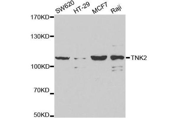 TNK2 antibody  (AA 70-385)
