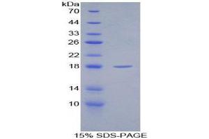 SDS-PAGE (SDS) image for Secreted Frizzled-Related Protein 1 (SFRP1) (AA 8-153) protein (His tag) (ABIN1525577)