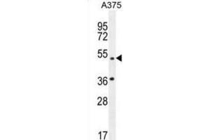 Western Blotting (WB) image for anti-Adaptor-Related Protein Complex 1, mu 1 Subunit (AP1M1) antibody (ABIN2996504) (AP1M1 antibody)