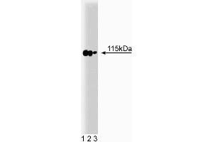 Western blot analysis of p115 on a rat cerebrum lysate. (ARHGAP4 antibody  (AA 843-955))