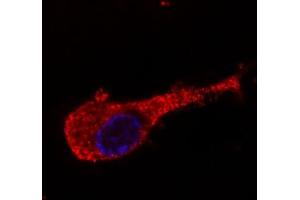 Immunofluorescence staining of neurofilament medium protein in murine Neuro2A cells by antibody conjugated with Dyomics 547 (red).
