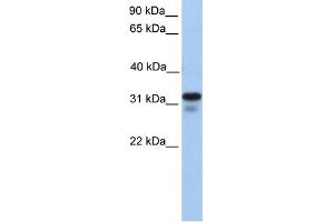 anti-Heparan Sulfate (Glucosamine) 3-O-Sulfotransferase 6 (HS3ST6) (C-Term) antibody