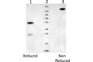 SDS-PAGE of rabbit anti-Mouse Serum Albumin. (Albumin antibody)