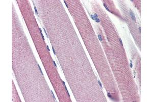 Hexokinase 2 antibody was used for immunohistochemistry at a concentration of 4-8 ug/ml. (Hexokinase 2 antibody  (N-Term))