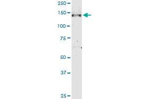 NPHP3 monoclonal antibody (M05), clone 3B1. (NPHP3 antibody  (AA 106-205))