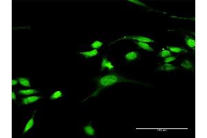 Immunofluorescence of purified MaxPab antibody to RASGRP3 on HeLa cell. (RASGRP3 antibody  (AA 1-690))