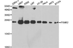 Western Blotting (WB) image for anti-Proteasome (Prosome, Macropain) Subunit, beta Type 2 (PSMB2) antibody (ABIN1876671) (PSMB2 antibody)