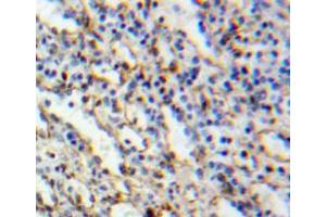 Used in DAB staining on fromalin fixed paraffin-embedded spleen tissue